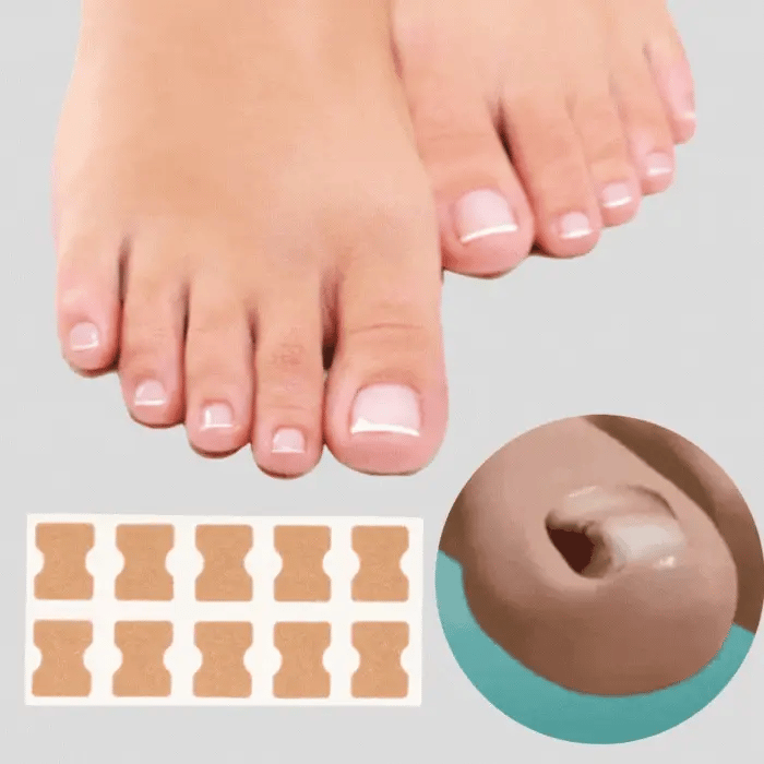 ToeFix+ Nail patches | Get rid of nail fungus for good!