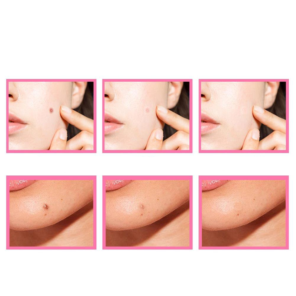 HerbCare™ Organic Serum for Skin Blemishes | Remove unsightly skin spots permanently!