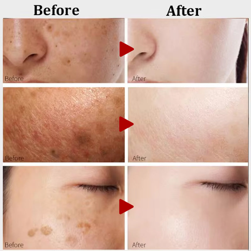 Bonatura™️ Turmeric Facial Serum