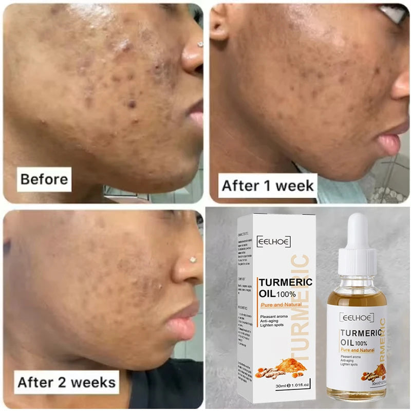 Bonatura™️ Turmeric Facial Serum
