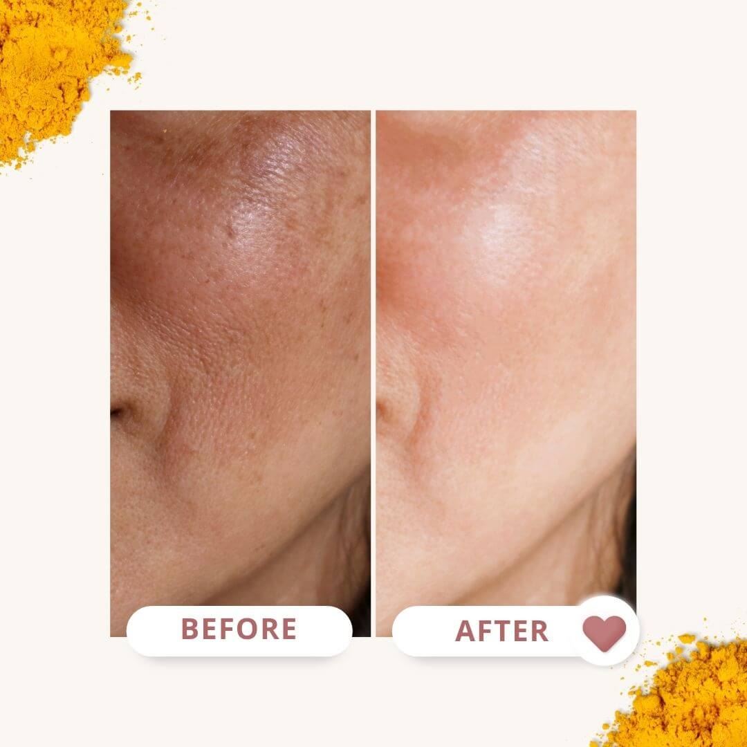 Bonatura™️ Turmeric Facial Serum