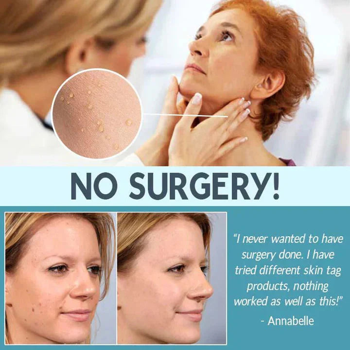 CoverLux™ Patches for removing skin spots and moles