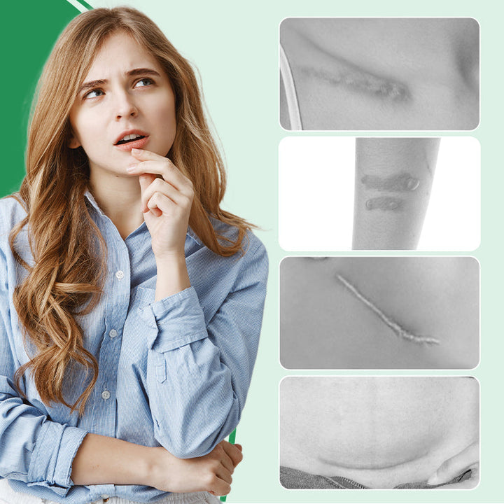 Dermarene™ Reusable Silicone Scar Plasters
