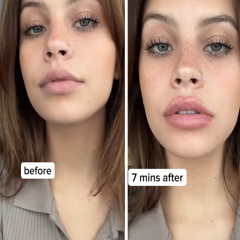 KissBeauty™ Instant Lip Plumper