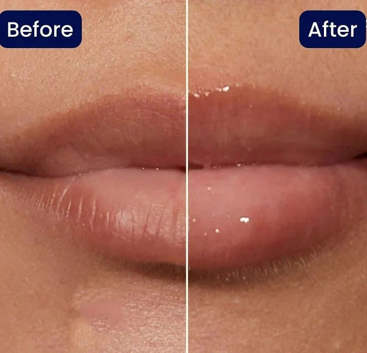KissBeauty™ Instant Lip Plumper