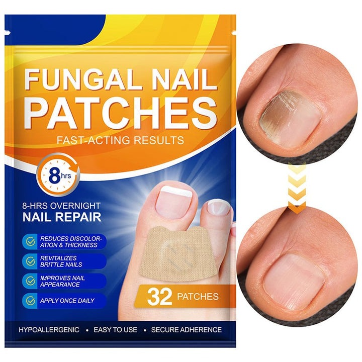 NailNex™ Effective Treatment for Nail Fungus