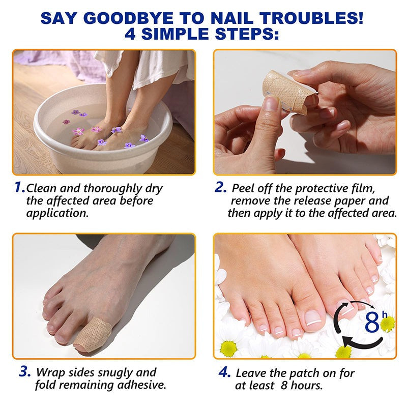NailNex™ Effective Treatment for Nail Fungus