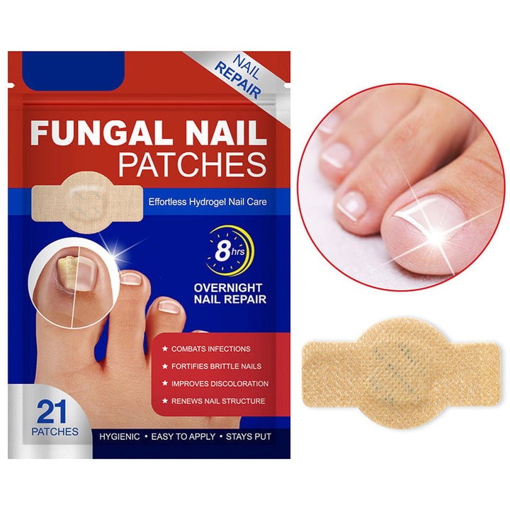 NailNex™ Effective Treatment for Nail Fungus