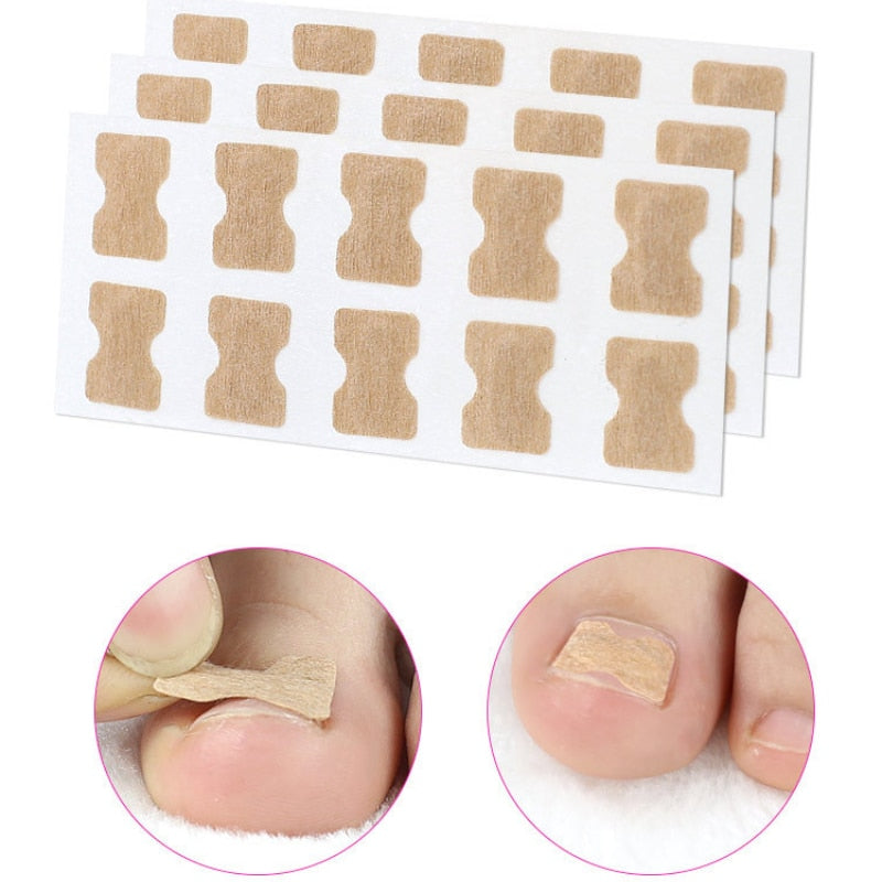 ToeFix+ Nail patches | Get rid of nail fungus for good!