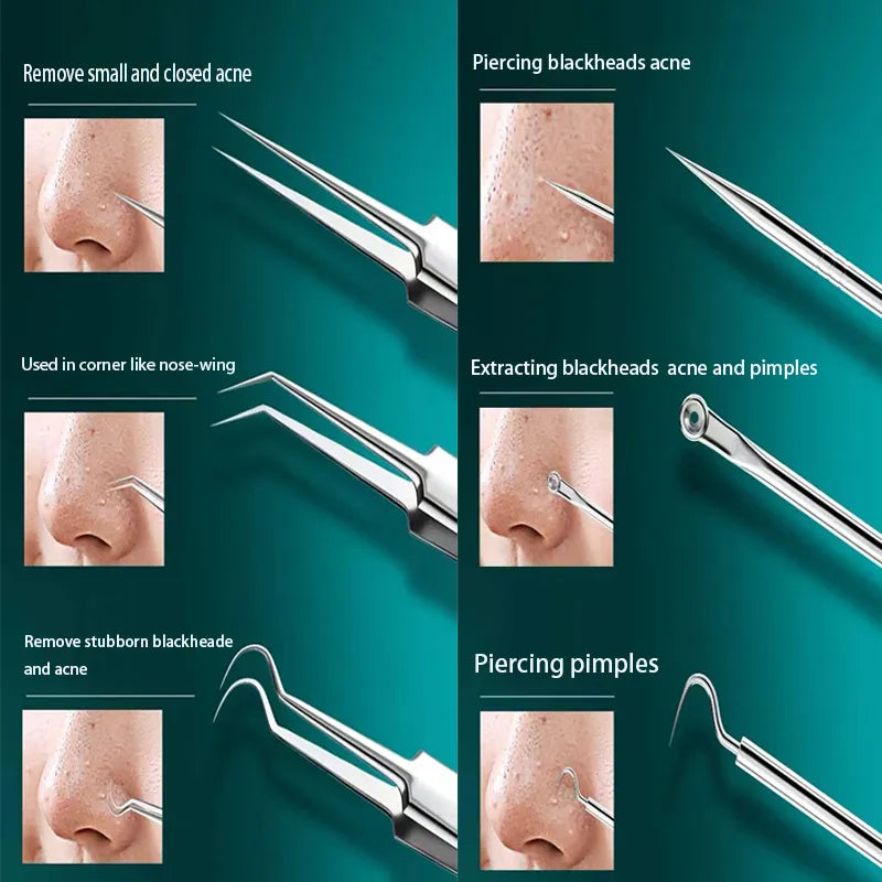 MrClean Set™ Blackhead removal kit