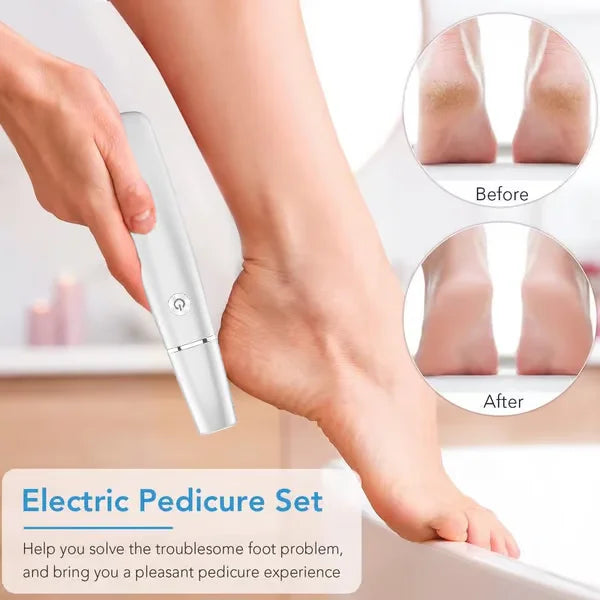 SilkPedi™ Electric Foot File