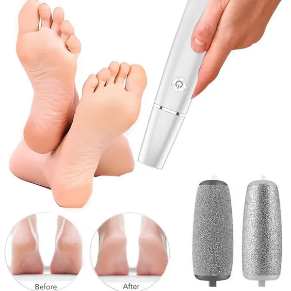 SilkPedi™ Electric Foot File