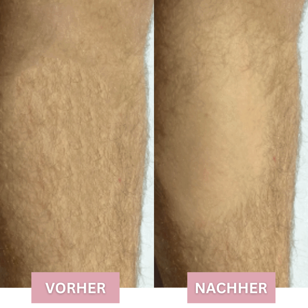 Silken Skin™ Hair Remover