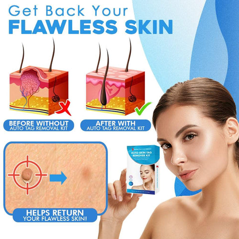 TagAway™ Advanced Callus Removal Kit