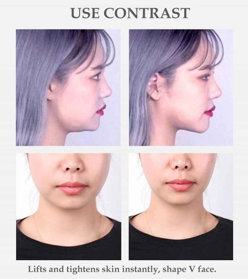 V-Lift™️ Invisible face lifting strip