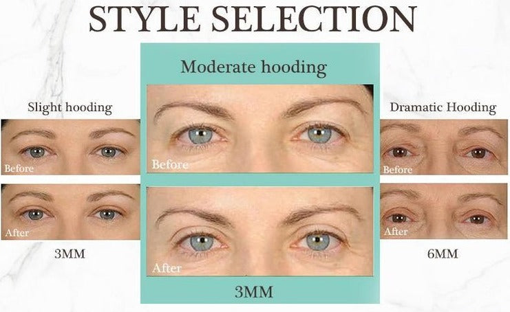 Lids By Verena™ Invisible eye lifting strips