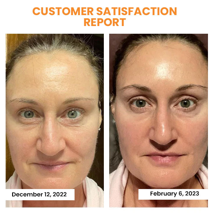 EELHOE™ Collagen mask for the set
