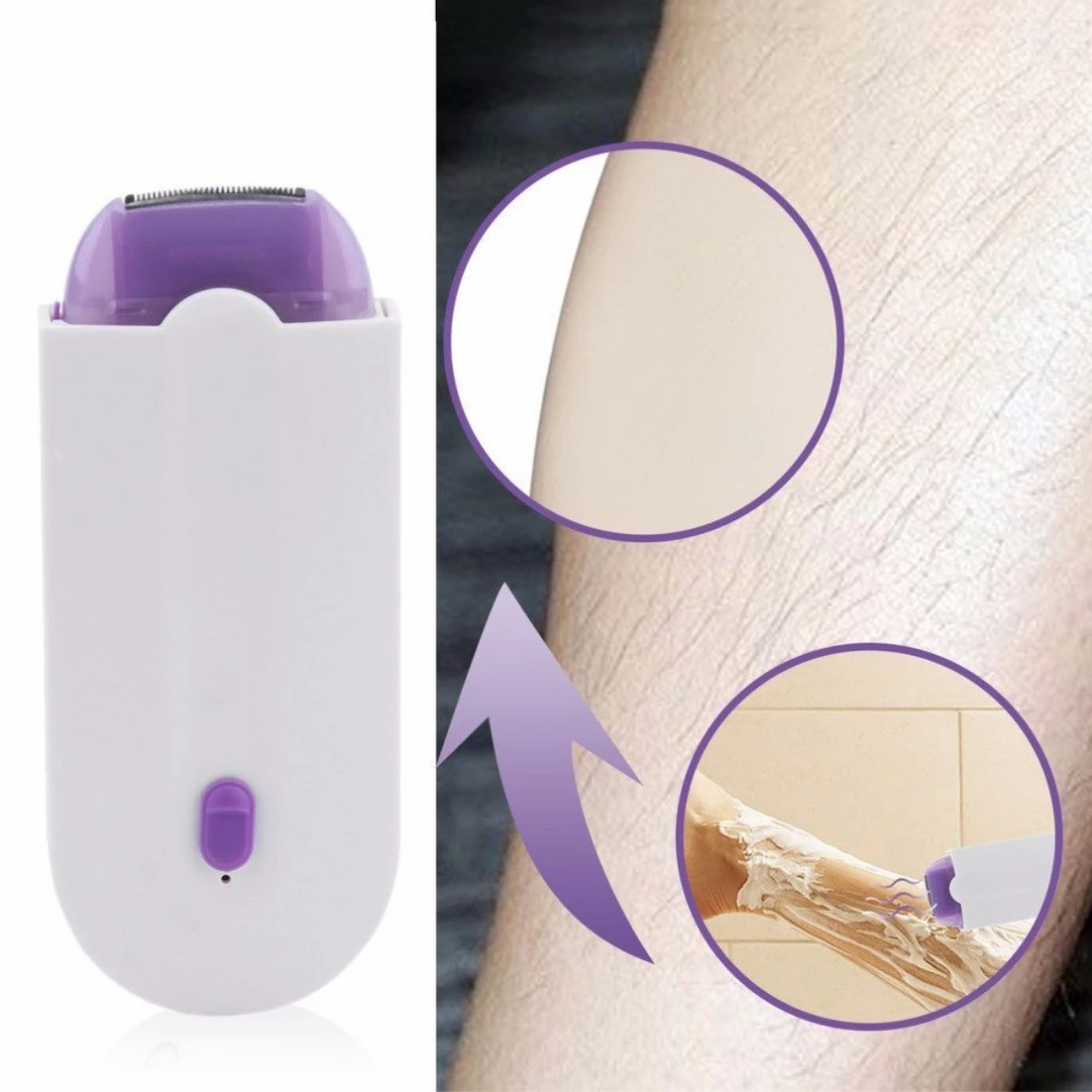 Benice Pro™ Hair Removal