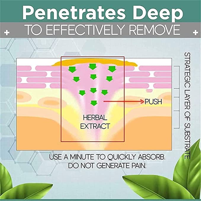FootPro™️ Corn removal gel