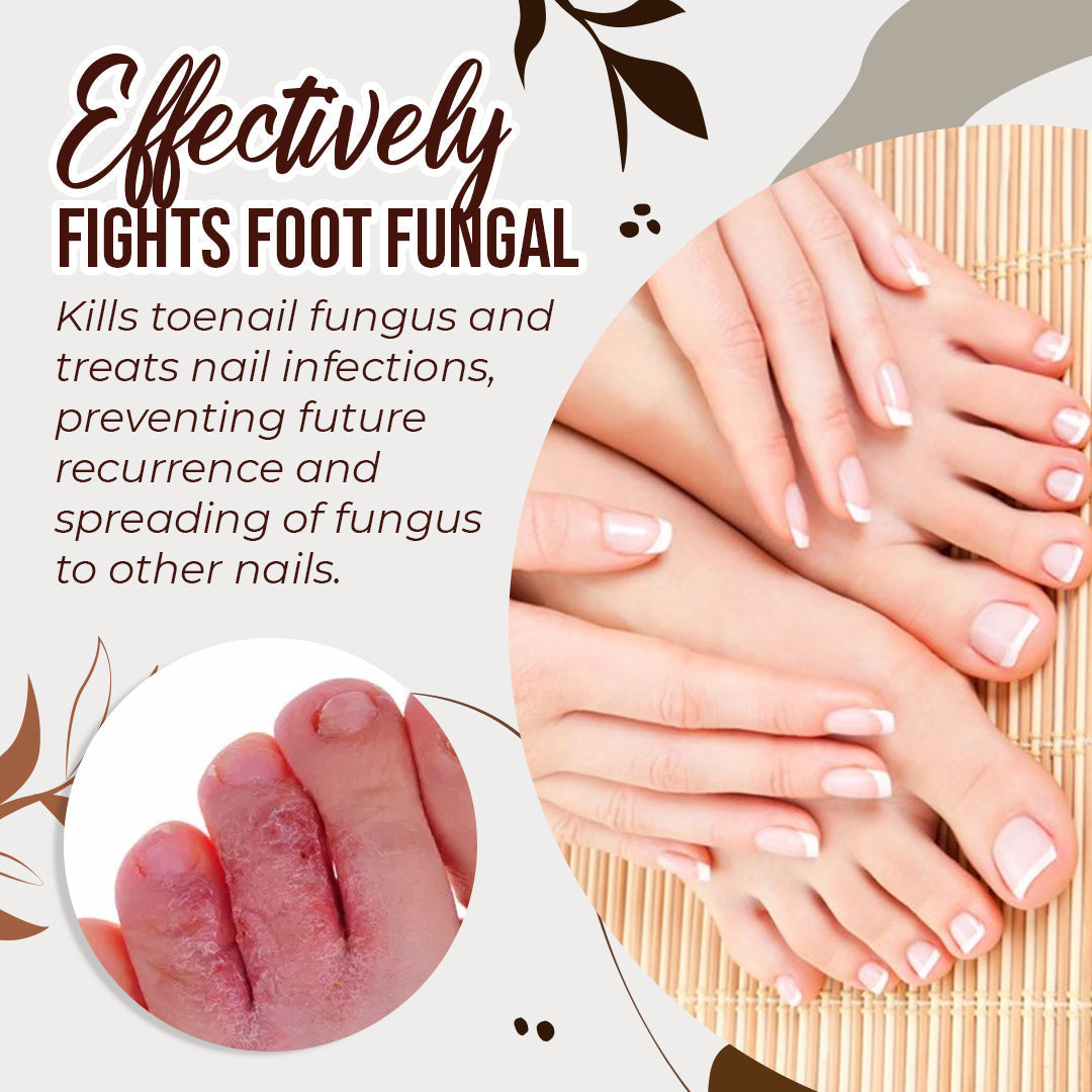 Herbcure™ Antifungal Spray