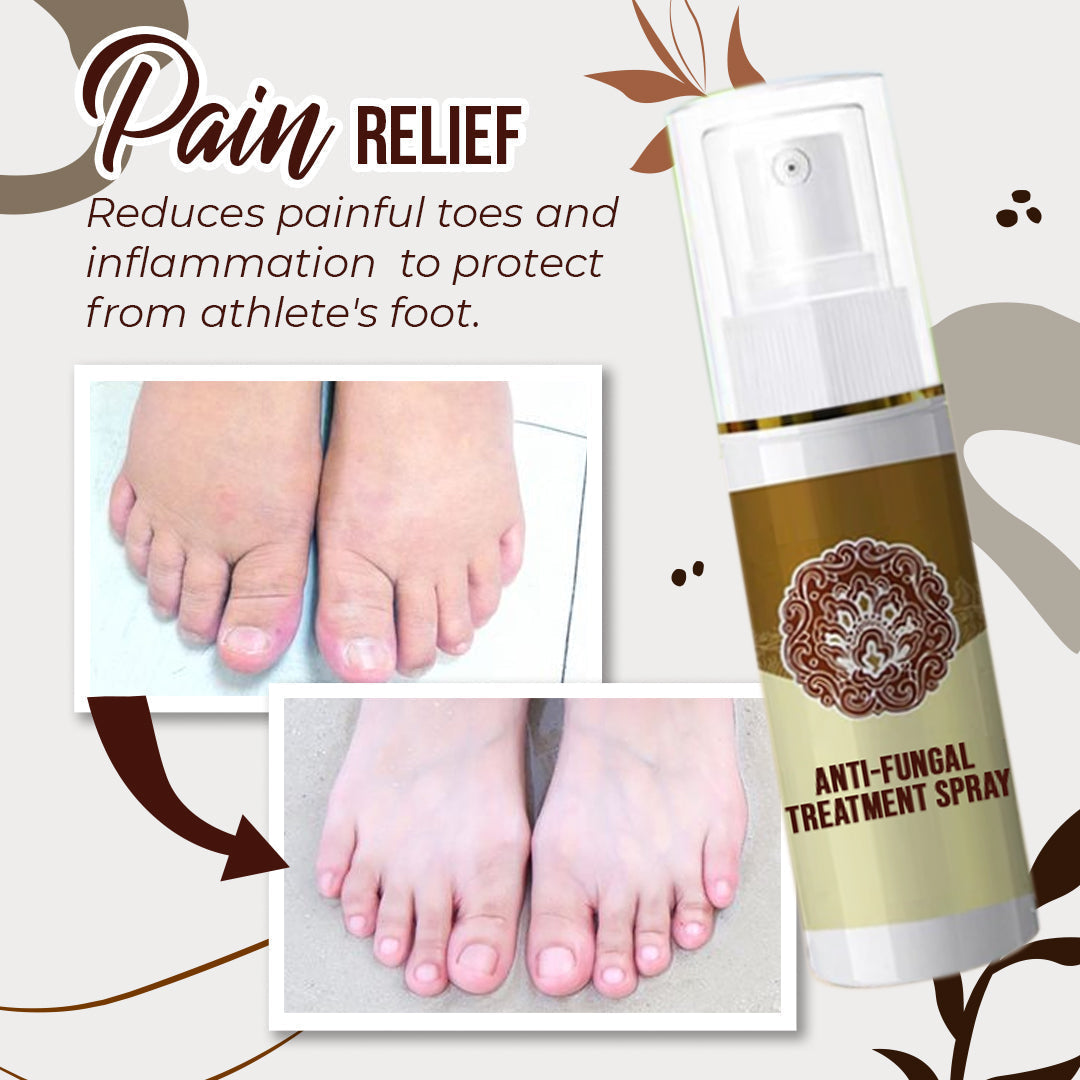 Herbcure™ Antifungal Spray