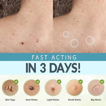 CoverLux™ Patches for removing skin spots and moles