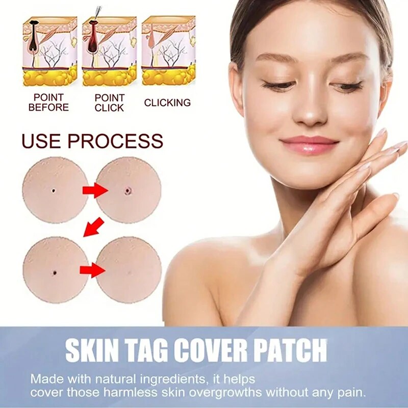 CoverLux™ Patches for removing skin spots and moles