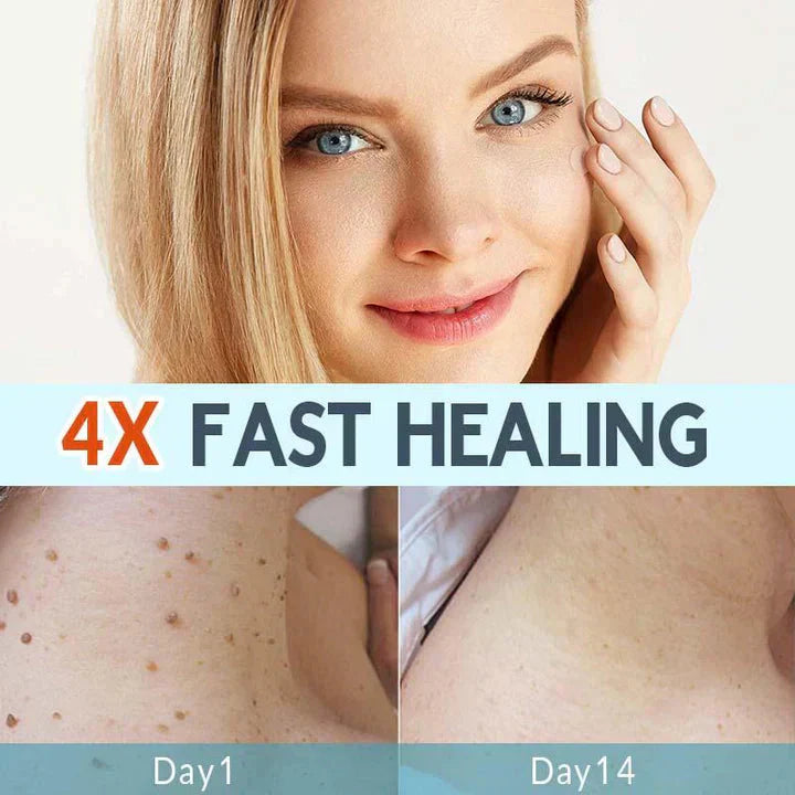 CoverLux™ Patches for removing skin spots and moles