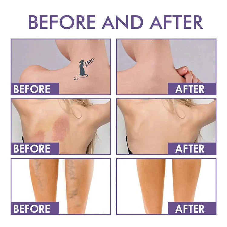 CoverSkin™ Covering concealer for the body