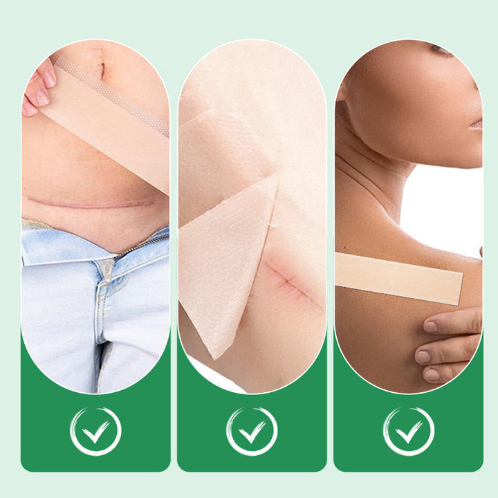 Dermarene™ Reusable Silicone Scar Plasters