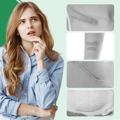 Dermarene™ Reusable Silicone Scar Plasters