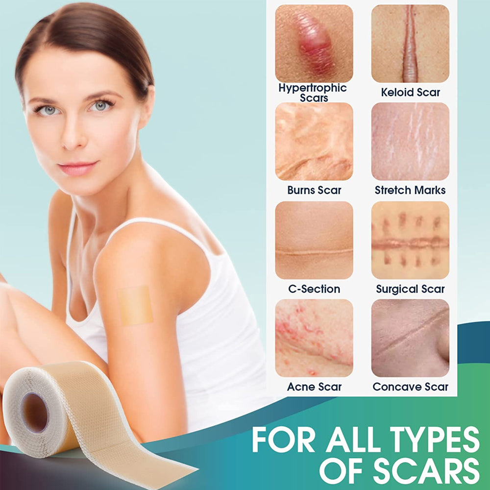 Dermarene™ Reusable Silicone Scar Plasters