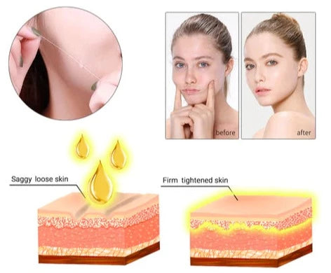 Instalift™ Skin lifting and rejuvenation kit with 24K protein wire