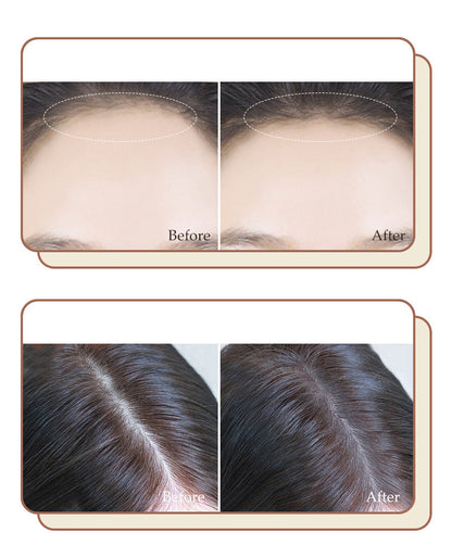 ShadowPowder™ Hairline Filling Powder | Waterproof and instant coverage