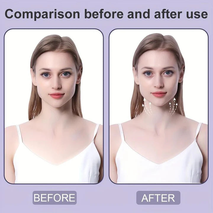 LiftLuxe™ Face Neck Lifting Tape