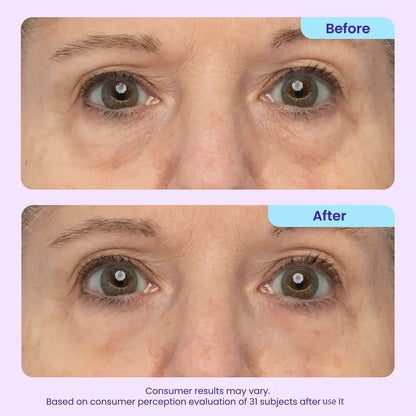 LiftVeil™ Depuffing Eye Gel for Smoother Mornings