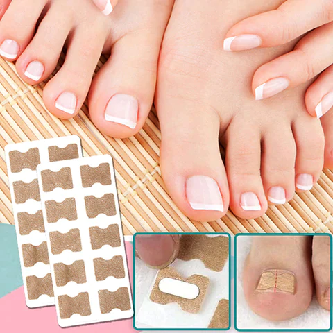 ToeFix+ Nail patches | Get rid of nail fungus for good!