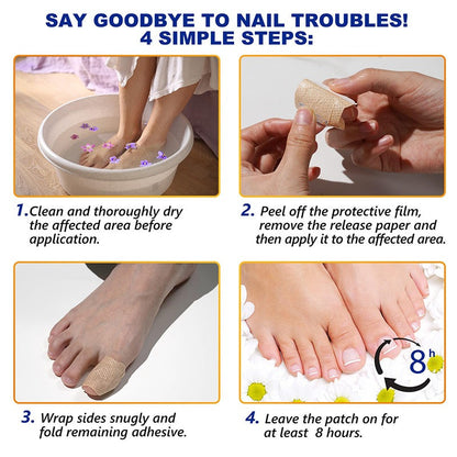 NailNex™ Effective Treatment for Nail Fungus