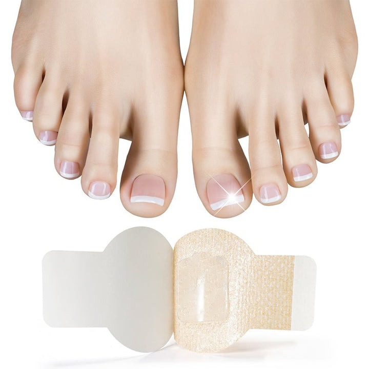 NailNex™ Effective Treatment for Nail Fungus