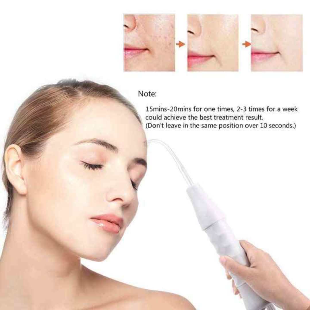 NueDerma™ High frequency skincare wand