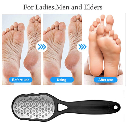 ScrapeBuddy™️ Stainless Steel Callus Shaver | You feel reborn and fulfilled!