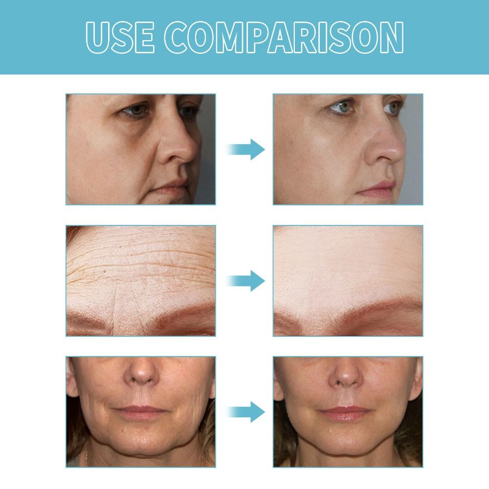 Serique™ Power Redo Anti Aging Cream (Wrinkle Fix）