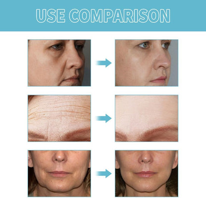 Serique™ Power Redo Anti Aging Cream (Wrinkle Fix）
