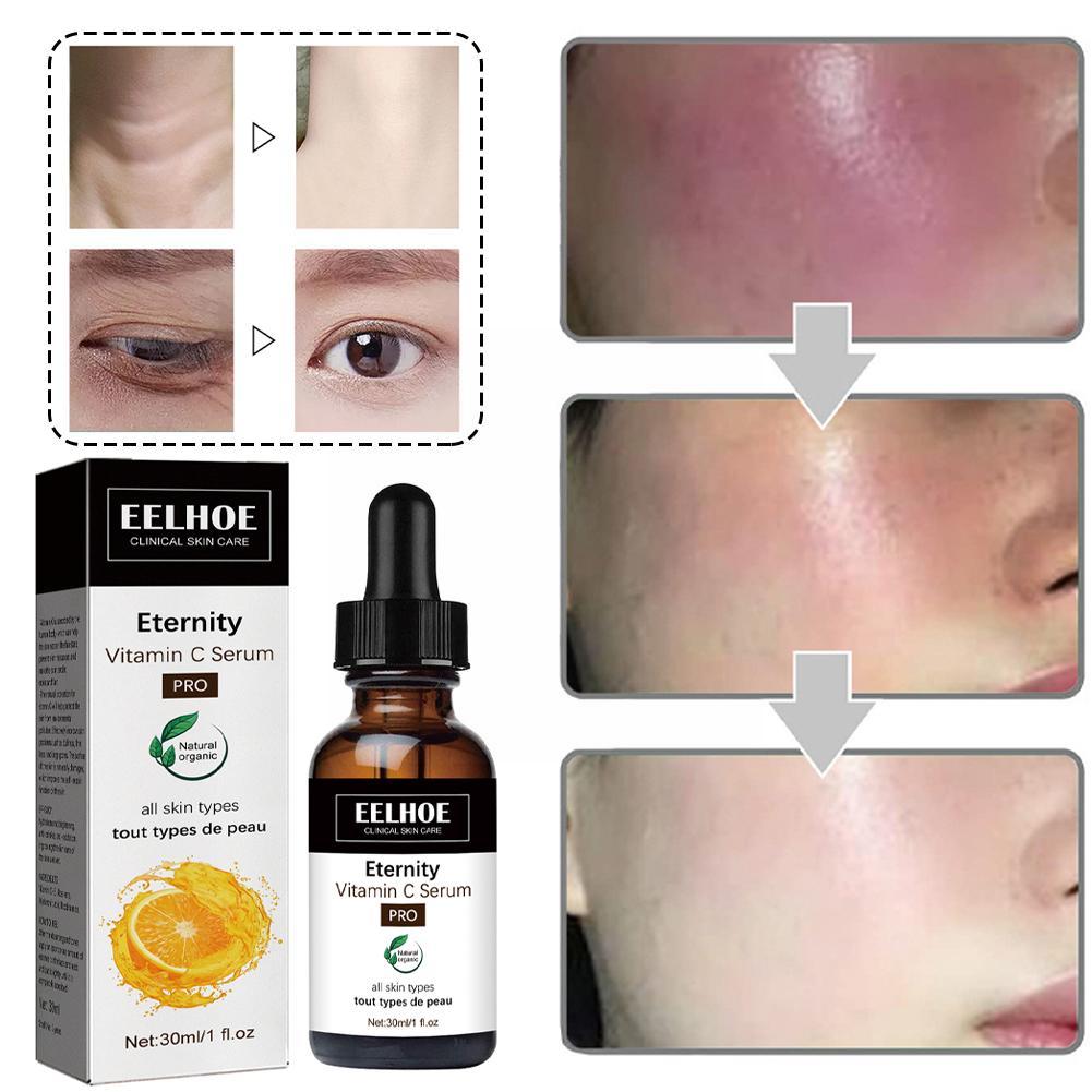 EELHOE Eternity™️ Skin Serum Correcting Dark Spots