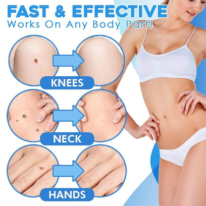 TagAway™ Advanced Callus Removal Kit