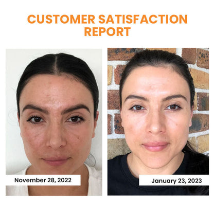 EELHOE™Anti-wrinkle cosmetics 2 in 1