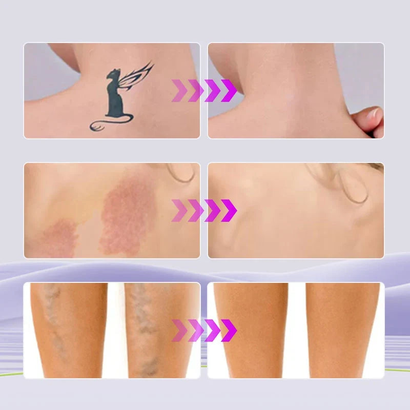 Covrané™ Waterproof Body Makeup for Smooth, Even Skin