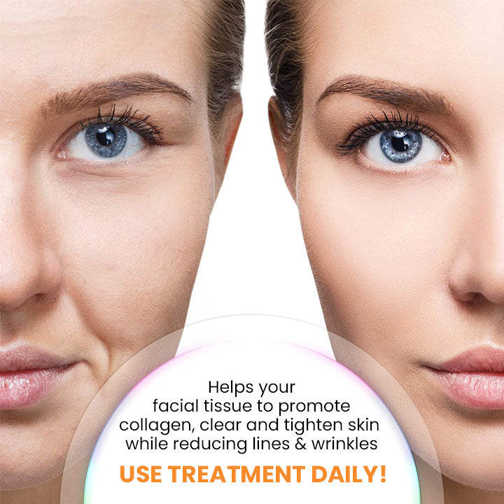 EELHOE™ Collagen mask for the set