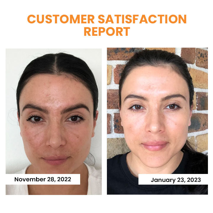 EELHOE™ Collagen mask for the set