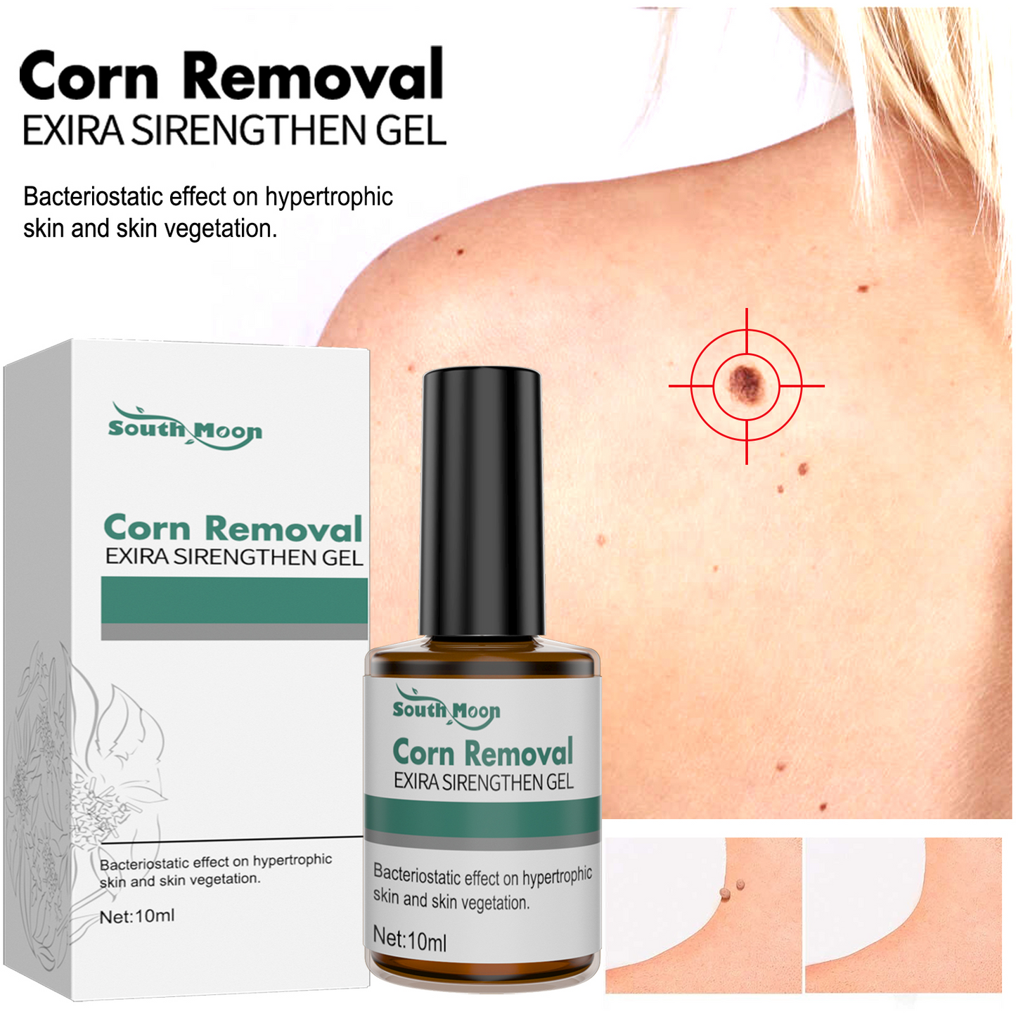 FootPro™️ Corn removal gel
